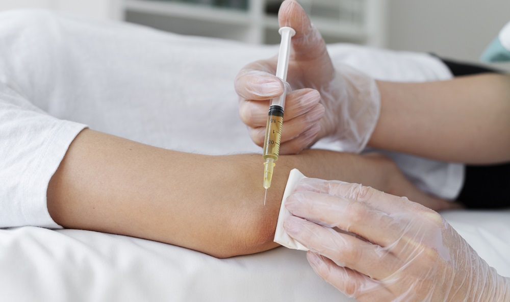 stem cell injections for arthritis