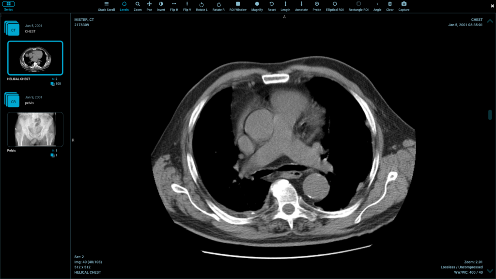 Real-Time Annotations Without WebSockets? html5 DICOM viewer open source