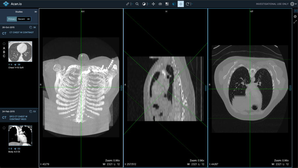 html5 DICOM viewer open source
